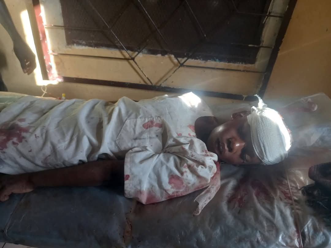 مجزرة داخل مسيد… مسيّرات الدعم السريع تقتل طلبة قرآن بشمال كردفان